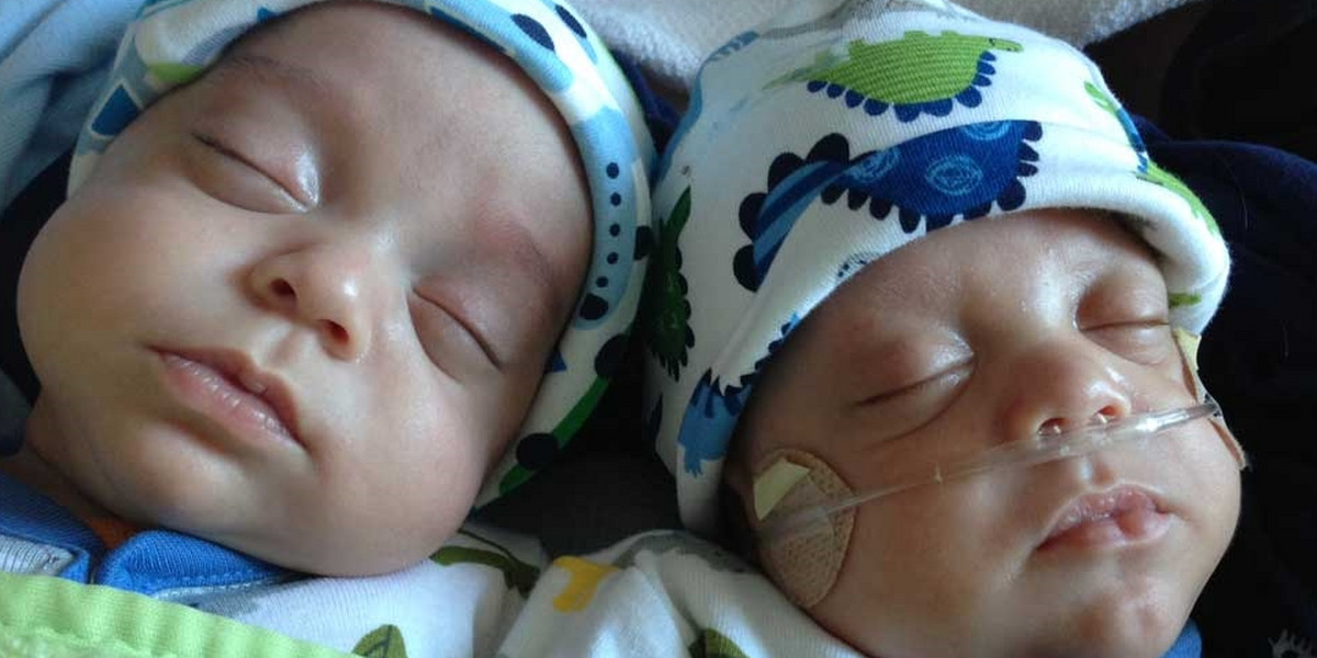 Te bliźniaki urodziły się w odstępie 39 dni