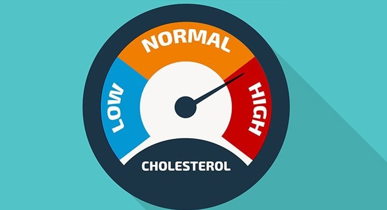 How to diagnose and manage your high cholesterol