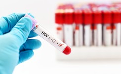 Każdego roku w Polsce od 1 do 4 tys. zakażeń HCV. Czym to grozi?