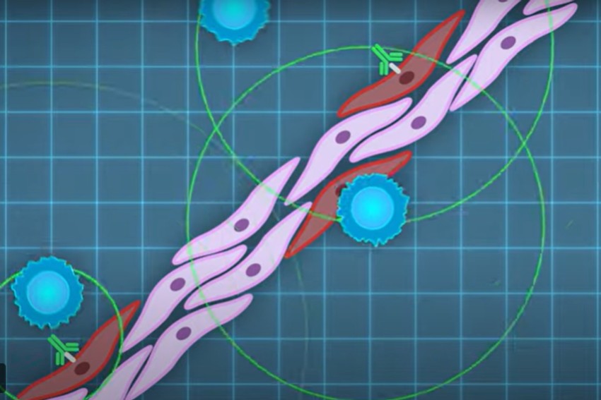 Istraživači su napravili "neneutralizujuća" antitela, koja obeležavaju zaražene ćelije pluća i regrutuju imuni sistem da se reši infekcije