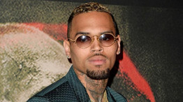 Extrém szépészeti beavatkozáson esett át Chris Brown 
