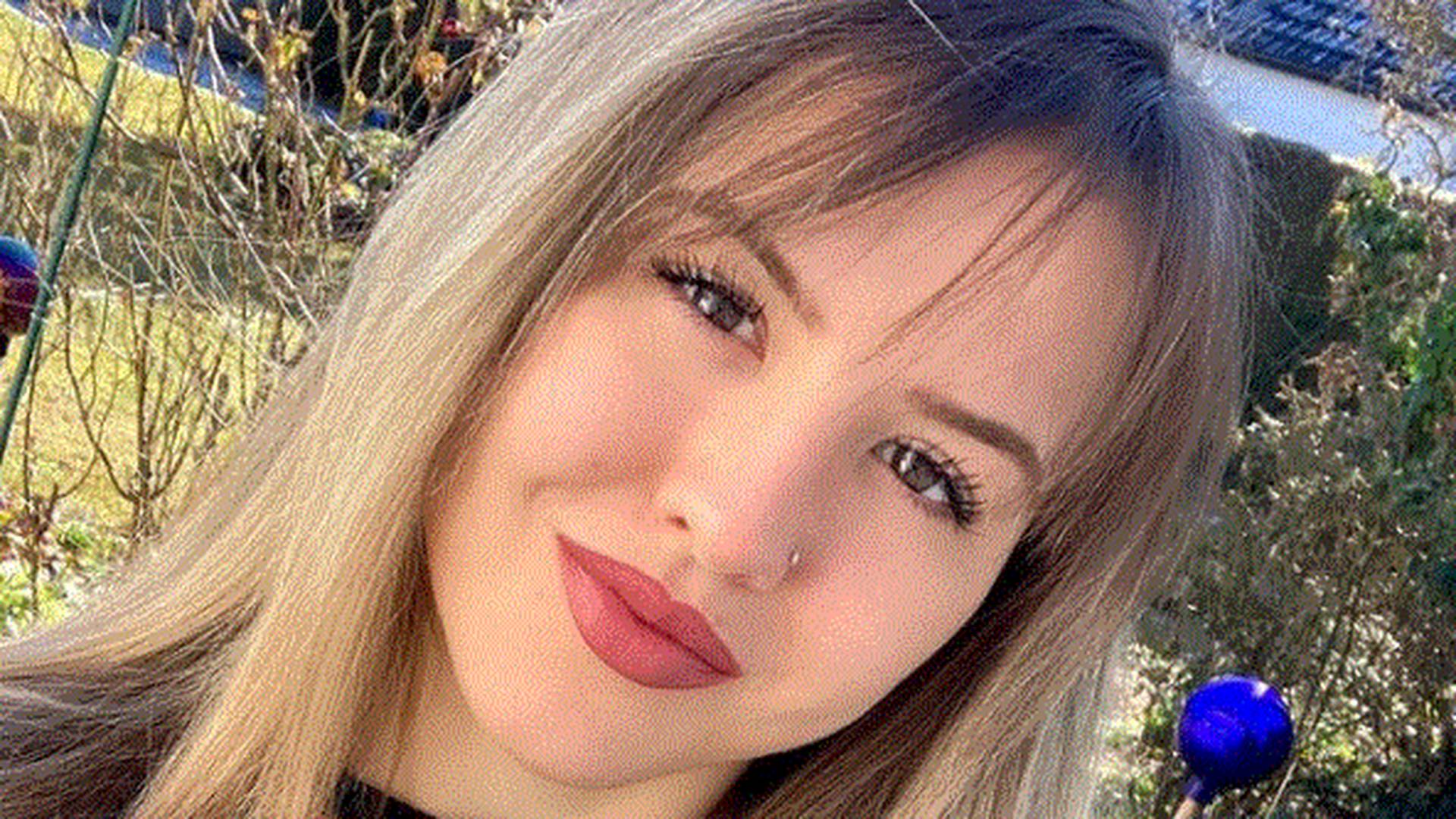 Űrlényfeje lett horrorsérülése után a 23 éves lánynak – Fotók