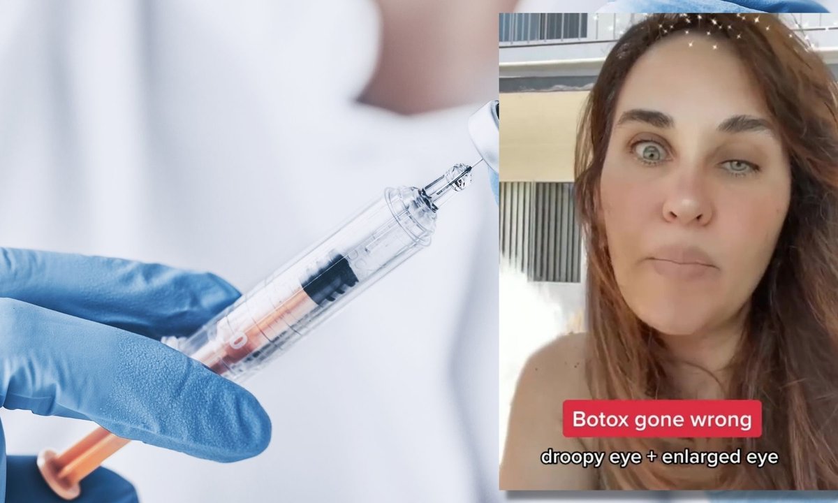 Zrobiła sobie botoks. Pokazała zdeformowaną twarz [wideo]