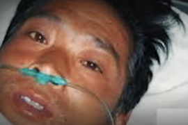 Ovaj čovek je UMRO U NAJGORIM MUKAMA koje ne biste poželili ni najgorem neprijatelju! Tačno 83 dana mu se KOŽA GULILA delić po delić dok mu KAPCI NISU OTPALI, a on je vapio da ga lekari PUSTE DA IZDAHNE