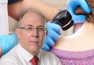 Svaka promena na koži može da se ukloni iz medicinskih ili estetskih razloga