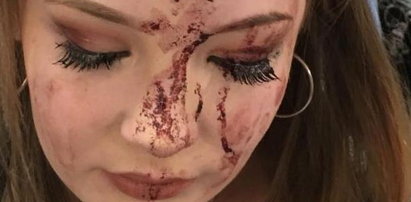 Koszmar na urodzinach! Nastolatka zalała się krwią