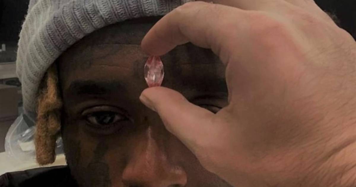 Kitépték Lil Uzi Vert homlokából a 24 millió dolláros rózsaszín gyémánt  ékszert - Noizz