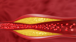 Jak obniżyć cholesterol całkowity? Porada lekarska