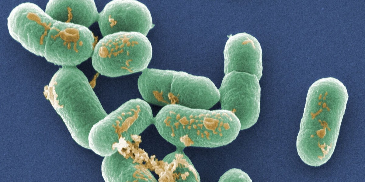 Listeria monocytogene