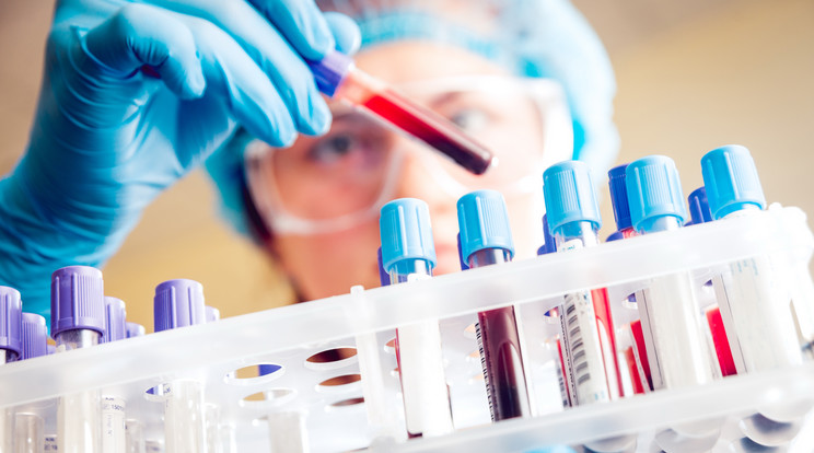 A vércsoport laborvizsgálattal, de akár otthoni gyorsteszttel is meghatározható  Fotó: Shutterstock