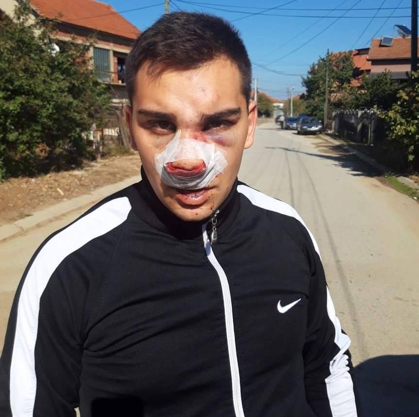 N.S. brutalno je pretučen u jednom vranjanskom kafiću