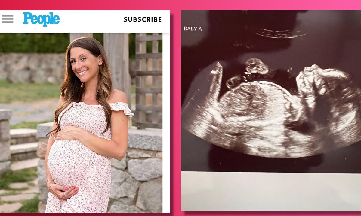 Taka ciąża zdarza się raz na 10 mln. "Byłam w szoku, gdy to zobaczyłam"