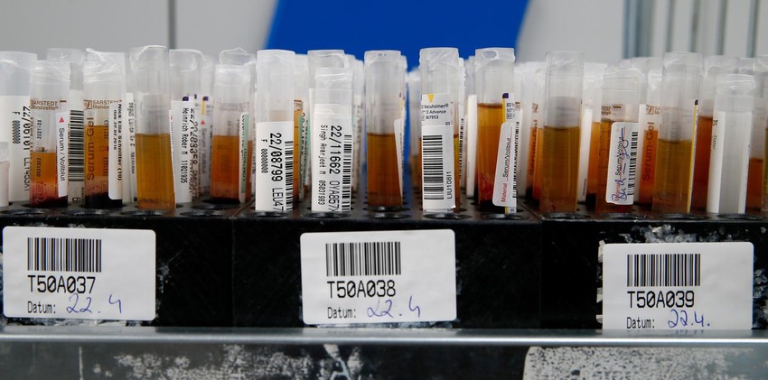 Što ozbiljnija klinička slika i više antitela