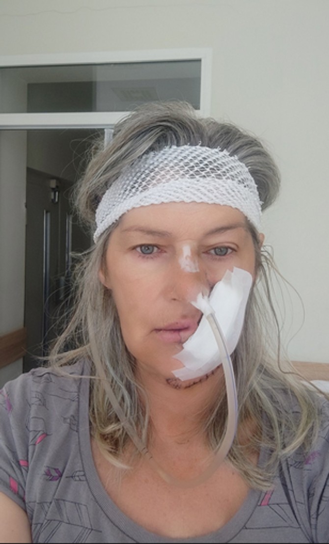 Zorka Veličković tokom zračenja