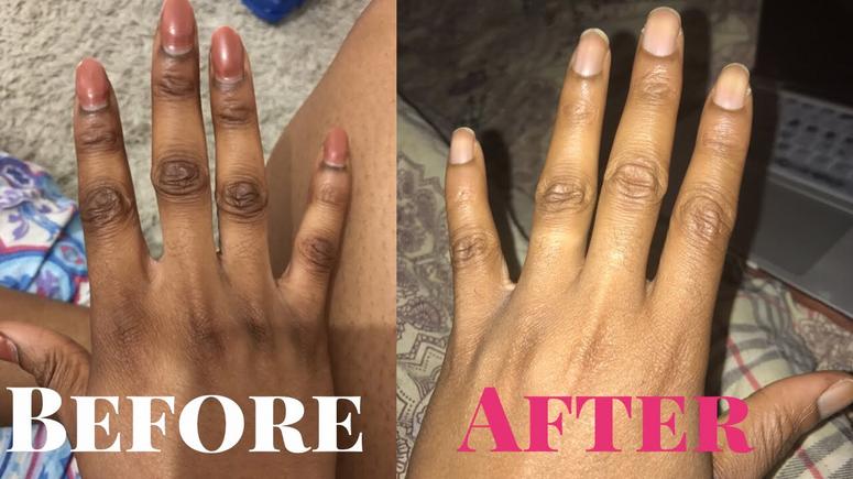 Dark Knuckles How To Use Baking Soda And Lime To Clear It Article Pulse Nigeria Baking soda is often used as an exfoliant to remove dead skin cells from the surface. dark knuckles how to use baking soda