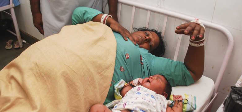 Ogromny noworodek urodzony w Indiach. Ważył prawie 6 kg