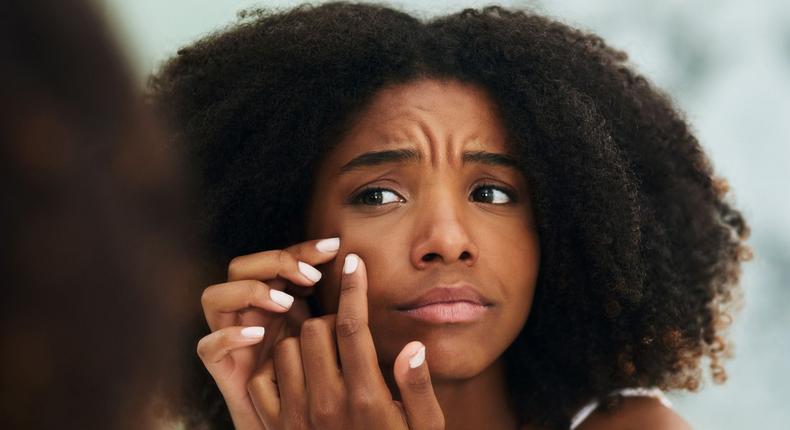 12 Bumps On Your Skin That You Should NEVER Pop