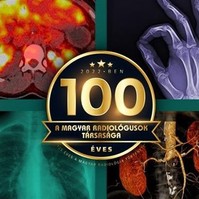 Így változtatta meg az orvoslást az "X-sugárzás" - 100 éves a Magyar Radiológusok Társasága