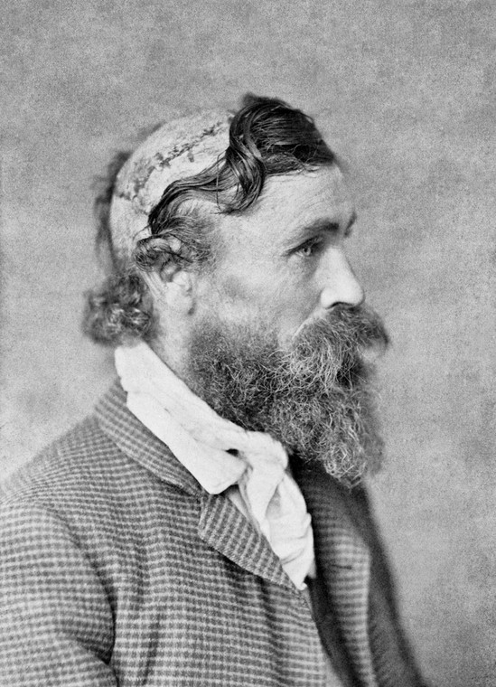 Robert McGee oskalpowany jako dziecko przez wodza Siuksów Małego Żółwia w 1864 r.