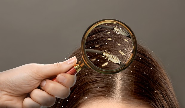 Gnjide mogu da budu žute, svetlosmeđe, braon ili bele, ali često izgledaju kao boja kose domaćina