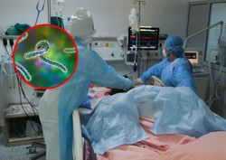 Czeka nas nowa epidemia? Śmiertelny wirus atakuje. Umiera 88 proc. zakażonych