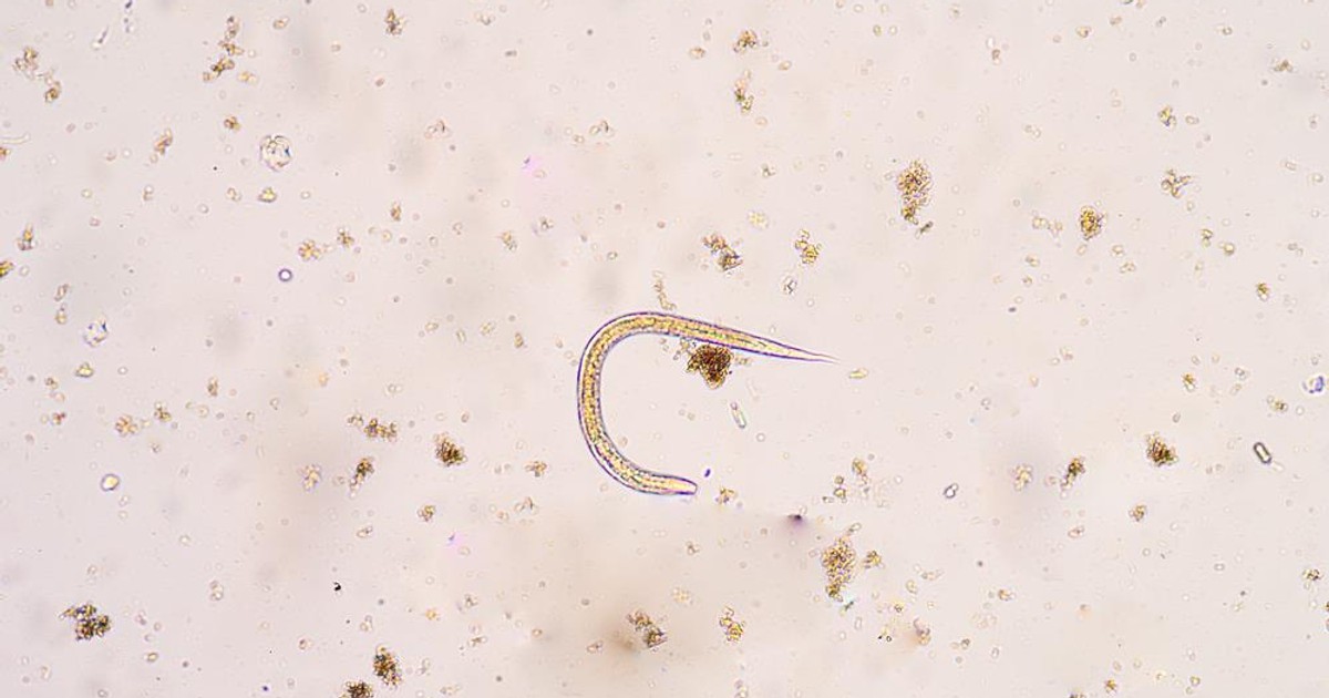 Pasożyty ludzkie: przyczyny, objawy, leczenie