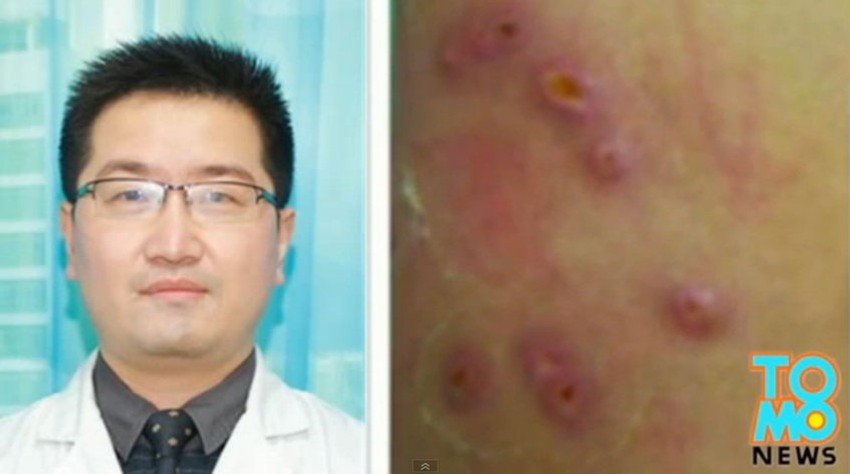 Tumbu muva, koja je prilično česta u istočnoj i centralnoj Africi, polaže jaja na zemlji