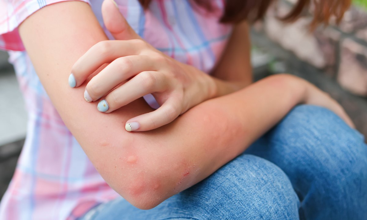 Walka z komarami w mieszkaniu. Ta metoda działa lepiej niż spray