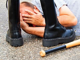 Wypadek, pobicie? Jakie masz prawo jako ofiara?