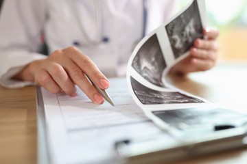 Méhpolip: 6 jel is utalhat rá, hogy már elindult a sejtburjánzás a méhben