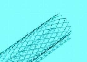 stent-d00000D611a213902bd56