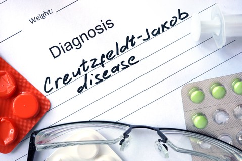 Creutzfeld-Jacob kór