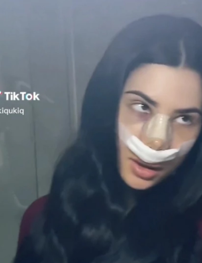 Uki Q, operacija nosa