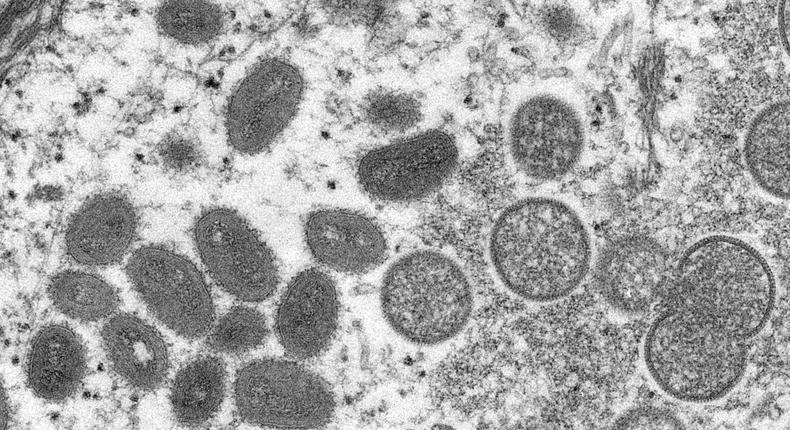 Electron microscope image of various virions (virus particles) of a monkeypox virus taken from human skin.Smith Collection/Gado/Getty Images
