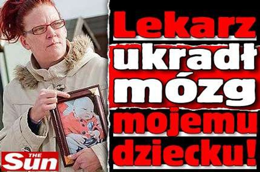 Lekarz ukradł mojemu dziecku mózg!