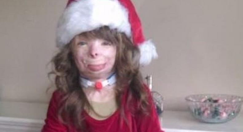 Meet disfigured toddler asking people to send her cards for Christmas