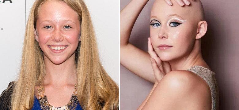 Młodziutka aktorka walczyła z rakiem piersi. Pokazała blizny po operacji 