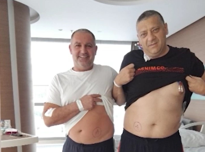 Branko je Siniši donirao bubreg