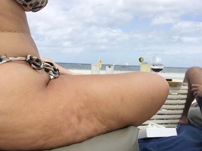 Ako želite da izbegnete ovakav izgled na plaži, nastavite da čitate ovaj tekst