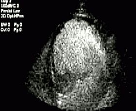 mikrobuborek-d0000172F6dc5b59c478d
