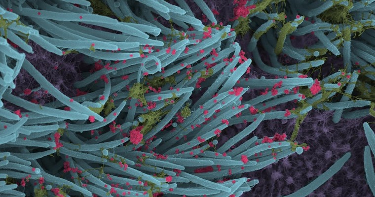 Koronawirus w przybliżeniu wygląda, jak malarstwo abstrakcyjne