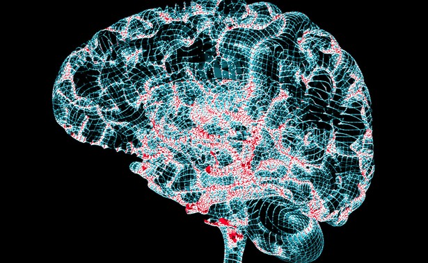 Choroba Alzheimera może mieć podłoże autoimmunologiczne