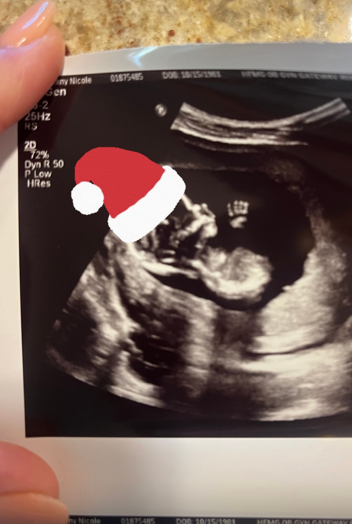 Tiffany Score a Steven Mills žalujú kliniku pre zámenu embryí.