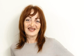 Snežana ima 68 godina i IZVAJANO TELO o kom mogu da sanjaju i devojke od 20: Pogledajte šta smo sve uradili na ovoj PREZGODNOJ ženi i kako sada izgleda