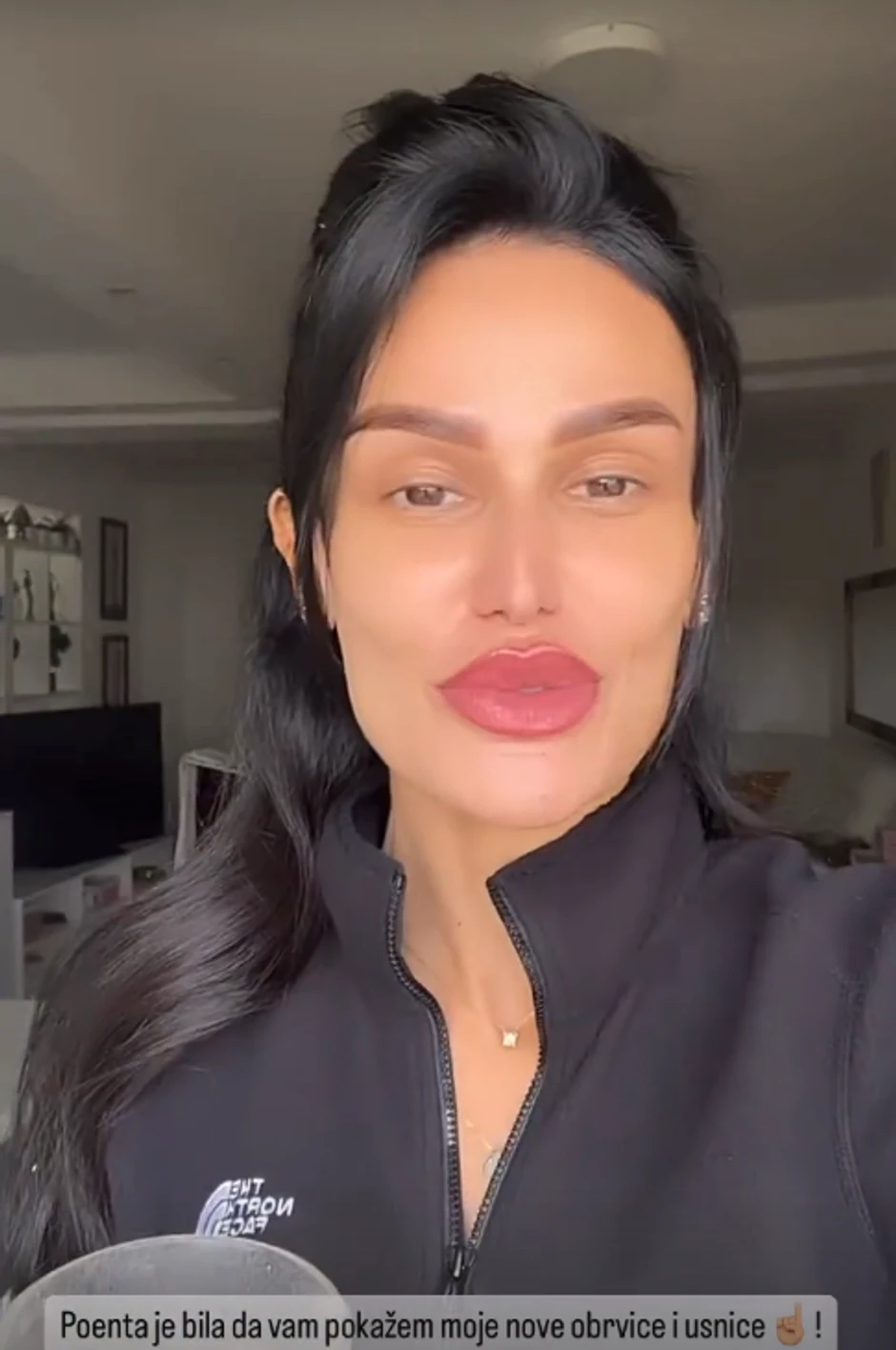 Indi Aradinović korigovala usne i obrve