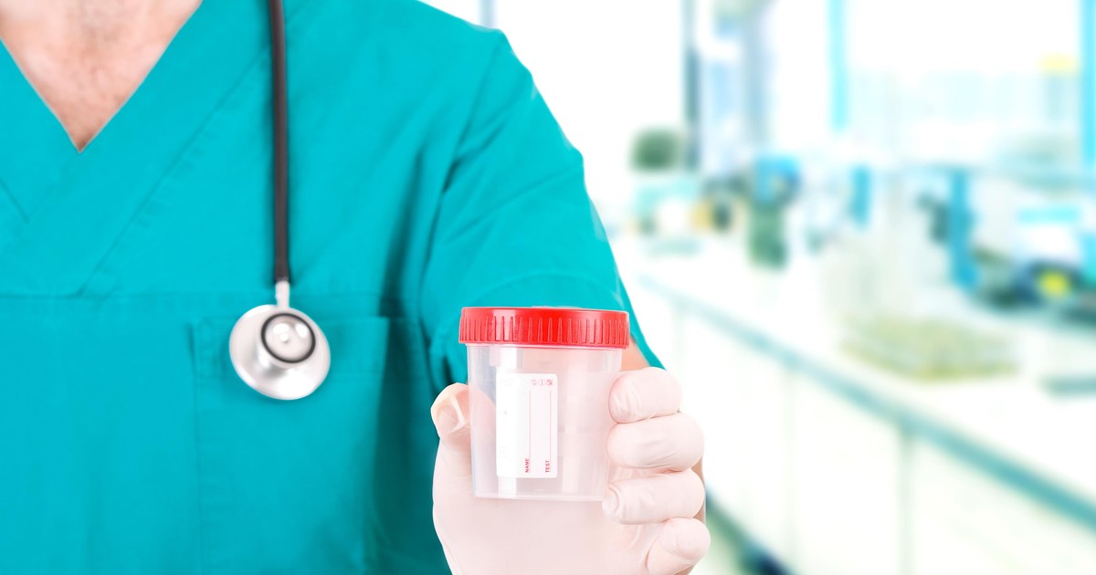 Posiew moczu przygotowanie do badania i interpretacja wyników