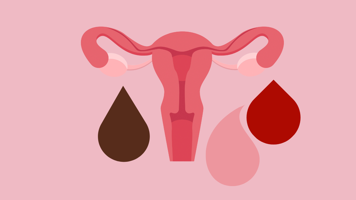 Ez próbálja jelezni neked a menstruációs vérzésed színe az egészségedről