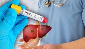 Hronični hepatitis B može izazvati rak jetre ili otkazivanje jetre i ubija oko 1,1 milion ljudi širom sveta svake godine
