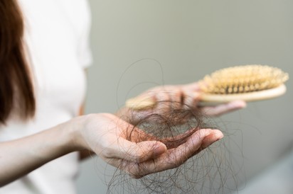 Hullik a haja? Ettől a ponttól már biztosan nem természetes