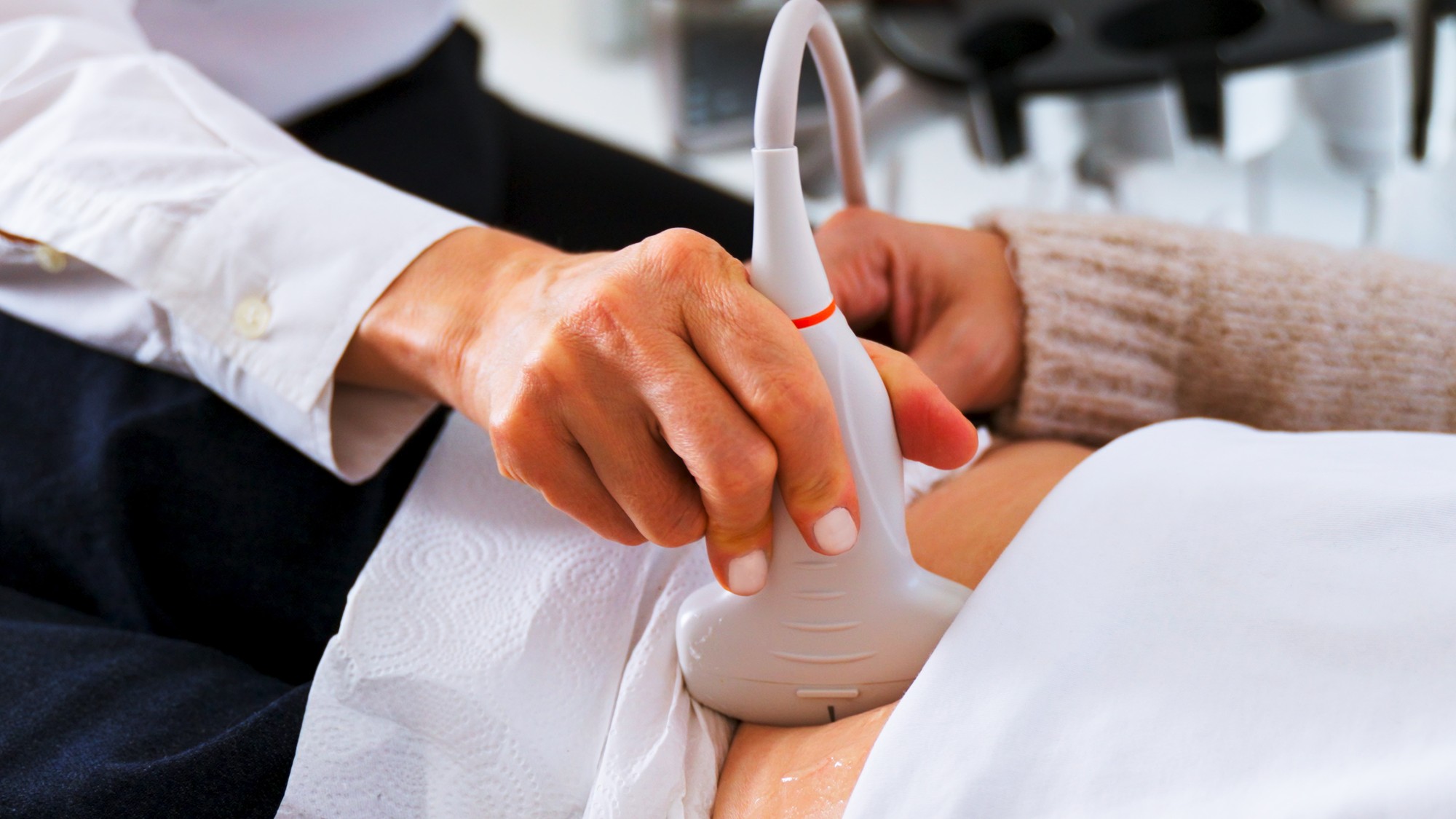 Uvedené príznaky nemusia hneď znamenať rakovinu, no je dôležité o nich hovoriť aj s gynekologičkou/gynekológom a absolvovať pravidelné vyšetrenie a preventívne prehliadky